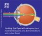 Healing the Eyes with Acupuncture Illustrated lessons and demonstrations with Julian Scott